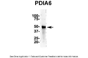 IP Suggested AntiPDIA6 Antibody Positive Control: NT2 CELL/BRAIN TISSUE (PDIA6 抗体  (N-Term))