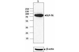 Western Blotting (WB) image for anti-Lymphocyte Cytosolic Protein 2 (SH2 Domain Containing Leukocyte Protein of 76kDa) (LCP2) (AA 216-434) antibody (ABIN2666114) (LCP2 抗体  (AA 216-434))