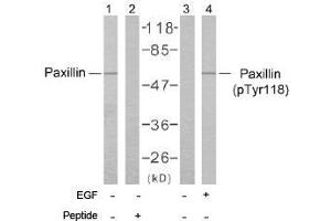 Image no. 2 for anti-Paxillin (PXN) (Tyr118) antibody (ABIN197278) (Paxillin 抗体  (Tyr118))