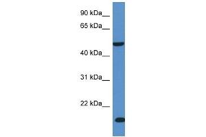 Western Blot showing INPP5K antibody used at a concentration of 1 ug/ml against Fetal Liver Lysate (INPP5K 抗体  (C-Term))