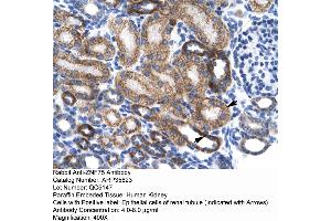 Human kidney (ZNF75 抗体  (Middle Region))