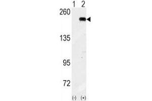 Western blot analysis of GCN2 antibody and 293 cell lysate (2 ug/lane) either nontransfected (Lane 1) or transiently transfected with the GCN2 gene (2).