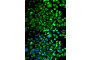 Immunofluorescence analysis of A549 cells using OSGEP antibody (ABIN5975559). (OSGEP 抗体)