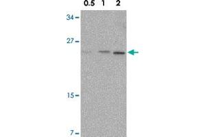Western blot analysis of NKIRAS1 in Raw 264. (NKIRAS1 抗体  (C-Term))