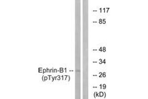 Western blot analysis of extracts from mouse brain, using EFNB1 (Phospho-Tyr317) Antibody. (Ephrin B1 抗体  (pTyr317))