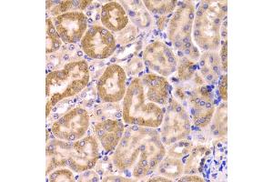Immunohistochemistry of paraffin-embedded mouse kidney using CYP51A1 Antibody. (CYP51A1 抗体)