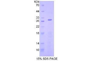 SDS-PAGE analysis of Human AIF Protein. (AIF 蛋白)