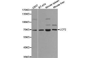 Western blot analysis of extracts of various cell lines, using LCP2 antibody. (LCP2 抗体  (AA 284-533))