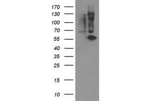 Western Blotting (WB) image for anti-Protein Phosphatase, Mg2+/Mn2+ Dependent, 1B (PPM1B) antibody (ABIN1500372) (PPM1B 抗体)