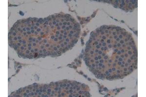 Used in DAB staining on fromalin fixed paraffin- embedded kidney tissue (APOA2 抗体  (AA 24-102))