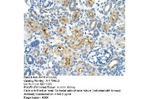 Human kidney (TAF6 抗体  (N-Term))