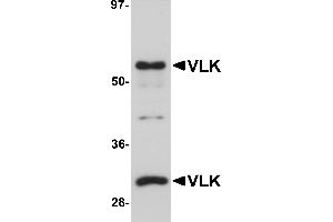 Western Blotting (WB) image for anti-Protein Kinase Domain Containing, Cytoplasmic Homolog (Mouse) (PKDCC) (Middle Region) antibody (ABIN1031161) (PKDCC 抗体  (Middle Region))