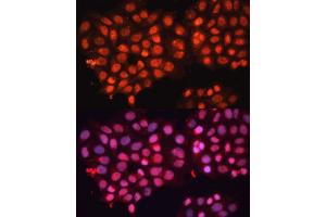 Immunofluorescence analysis of HeLa cells using  Polyclonal Antibody (ABIN3016382, ABIN3016383, ABIN3016384 and ABIN6219737) at dilution of 1:100 (40x lens). (ABCB8 抗体  (AA 469-718))