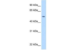 WB Suggested Anti-NEU1 Antibody Titration:  5. (NEU1 抗体  (Middle Region))