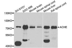Western blot analysis of extracts of various cell lines, using ACHE antibody. (Acetylcholinesterase 抗体  (AA 398-617))