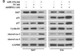 MBNL1-AS1 regulated the proliferation and apoptosis of BC cells via miR-135a/PHLPP2/FOXO1 axis. (Ki-67 抗体  (AA 700-800))
