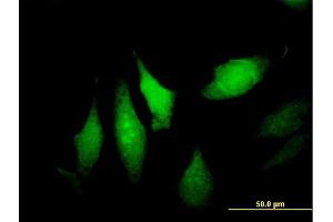 Immunofluorescence of purified MaxPab antibody to DNALI1 on HeLa cell. (DNALI1 抗体  (AA 1-258))