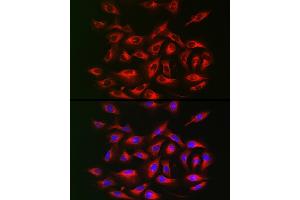 Immunofluorescence analysis of U2OS cells using IRS2 Rabbit pAb (ABIN6128094, ABIN6142544, ABIN6142545 and ABIN6223949) at dilution of 1:25 (40x lens). (IRS2 抗体  (AA 510-650))