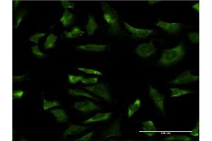 Immunofluorescence of monoclonal antibody to LOC402176 on HeLa cell. (RPL21P44 抗体  (AA 1-136))