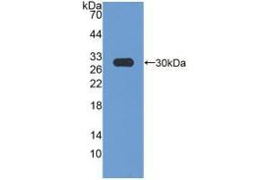 Western blot analysis of recombinant Rat HMGCR. (HMGCR 抗体  (AA 638-887))