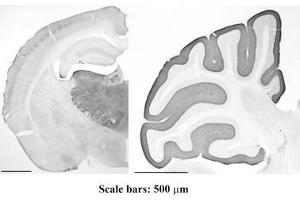 Mouse brain staining, thalamus and cortex (left) and molecular layer of cerebellum (right). (Cav3.1 Ca2+ Channel (AA 2052-2172), (C-Term), (Cytosolic) 抗体)