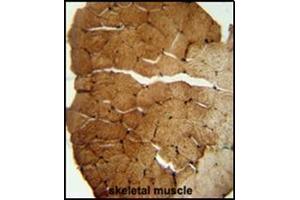 Immunohistochemistry (Paraffin-embedded Sections) (IHC (p)) image for anti-Solute Carrier Family 35, Member B2 (SLC35B2) (AA 400-429), (C-Term) antibody (ABIN954822)