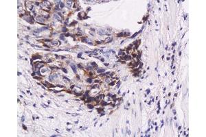 Immunohistochemistry (Paraffin-embedded Sections) (IHC (p)) image for anti-Zinc Finger, Matrin-Type 3 (ZMAT3) (AA 201-288) antibody (ABIN730108)