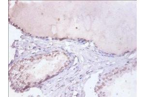 Immunohistochemistry of paraffin-embedded human prostate tissue using ABIN7155104 at dilution of 1:100 (HNRNPD/AUF1 抗体  (AA 18-355))