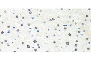Immunohistochemistry of paraffin-embedded Rat liver using PPP4C Polyclonal Antibody at dilution of 1:100 (40x lens). (PPP4C 抗体)