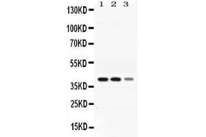 Western blot analysis of ADH4 expression in rat liver extract ( Lane 1), mouse liver extract ( Lane 2) and HEPG2 whole cell lysates ( Lane 3). (ADH4 抗体  (AA 218-380))
