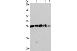 Western Blotting (WB) image for anti-Nicotinamide phosphoribosyltransferase (NAMPT) antibody (ABIN2428901) (NAMPT 抗体)
