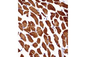 ACTA1/alpha -actin Antibody immunohistochemistry analysis in formalin fixed and paraffin embedded human skeletal muscle followed by peroxidase conjugation of the secondary antibody and DAB staining. (Actin 抗体  (C-Term))