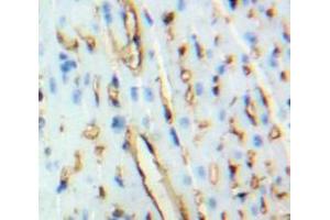 Used in DAB staining on fromalin fixed paraffin-embedded Heart tissue (BNP 抗体  (AA 77-121))