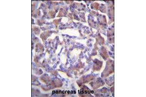 PRSS3 Antibody immunohistochemistry analysis in formalin fixed and paraffin embedded human pancreas tissue followed by peroxidase conjugation of the secondary antibody and DAB staining. (PRSS3 抗体  (AA 136-163))
