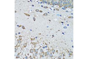 Immunohistochemistry of paraffin-embedded mouse brain using FDFT1 antibody (ABIN5973667) at dilution of 1/100 (40x lens). (FDFT1 抗体)