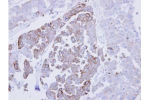 IHC-P Image Immunohistochemical analysis of paraffin-embedded OVCAR3 xenograft, using ERP29, antibody at 1:500 dilution. (ERP29 抗体)