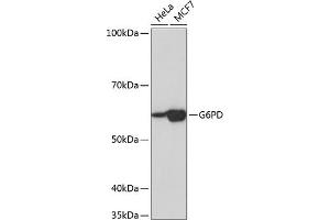 Western blot analysis of extracts of various cell lines, using G6PD Rabbit mAb (ABIN7267402) at 1:1000 dilution. (Glucose-6-Phosphate Dehydrogenase 抗体)