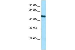 WB Suggested Anti-PLA2G3 Antibody Titration: 1. (PLA2G3 抗体  (C-Term))