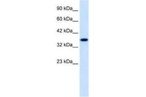 Western Blotting (WB) image for anti-Zinc Finger Protein 75 (ZNF75) antibody (ABIN2461224) (ZNF75 抗体)