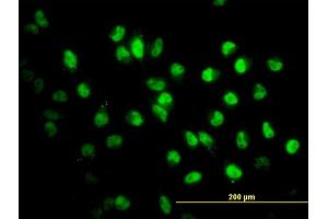 Immunofluorescence (IF) image for anti-Stromal Antigen 2 (STAG2) (AA 1130-1231) antibody (ABIN564681)
