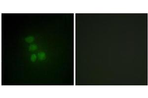 Immunofluorescence analysis of HepG2 cells, using hnRNP G antibody. (RBMX 抗体  (N-Term))