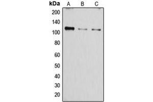 Western blot analysis of SERCA1 expression in A549 (A), mouse muscle (B), rat muscle (C) whole cell lysates.