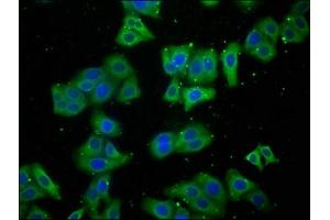 Immunofluorescence staining of HepG2 cells with ABIN7158034 at 1:100, counter-stained with DAPI. (LARS 抗体  (AA 614-892))