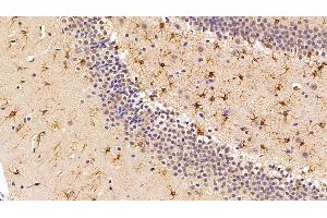 Immunohistochemistry (IHC) image for anti-Sirtuin 3 (SIRT3) (AA 127-303) antibody (ABIN7435925)