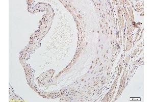 Formalin-fixed and paraffin embedded rat aorta labeled with Anti-LOX-1 Polyclonal Antibody, Unconjugated  followed by conjugation to the secondary antibody and DAB staining