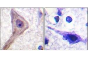 Immunohistochemistry analysis of paraffin-embedded human brain tissue, using Akt1 S1 (Ab-246) Antibody. (PRAS40 抗体  (AA 207-256))