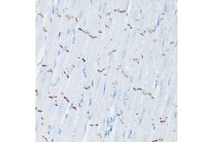 Immunohistochemistry of paraffin-embedded rat heart using N-Cadherin Rabbit pAb (ABIN3017242, ABIN3017243, ABIN3017244 and ABIN6220011) at dilution of 1:50 (40x lens). (N-Cadherin 抗体  (AA 750-850))