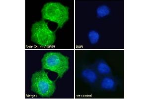 ABIN334381 Immunofluorescence analysis of paraformaldehyde fixed A431 cells, permeabilized with 0. (CXCR3 抗体  (C-Term))