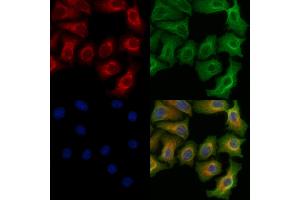 ABIN6255025 and ABIN6266462 staining Hela cells(heat shock treatment) by IF/ICC. (RIPK2 抗体  (pSer176))