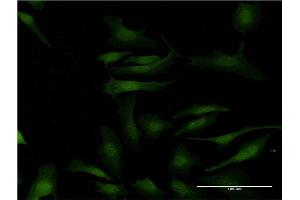 Immunofluorescence of monoclonal antibody to MAPKAPK2 on HeLa cell. (MAPKAP Kinase 2 抗体  (AA 266-352))